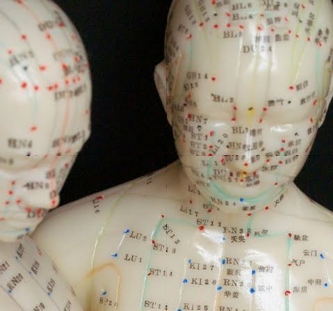 What Does Acupuncture Treat?